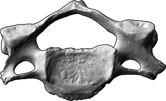 4. Halswirbel (vertebra cervicale 4) (Bestattungen von Mensch und Tier, Skelettrest aus Knochen)