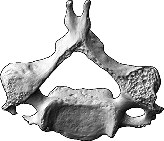 5. Halswirbel (vertebra cervicale 5) (Bestattungen von Mensch und Tier, Skelettrest aus Knochen)